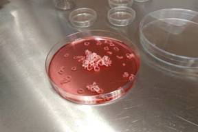 Debido a su tendencia innata a contraerse, las células forman anillos